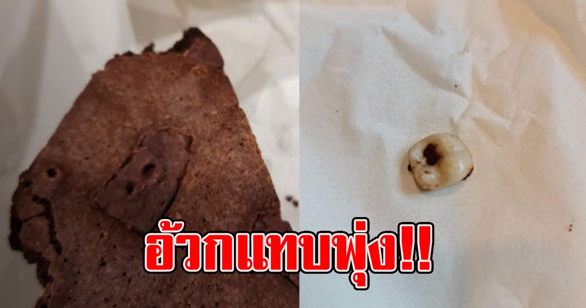 สาว กำลังกินบราวนี่ของร้านกาแฟร้านดัง เจอ ฟัน แฝงมาทั้งซี่
