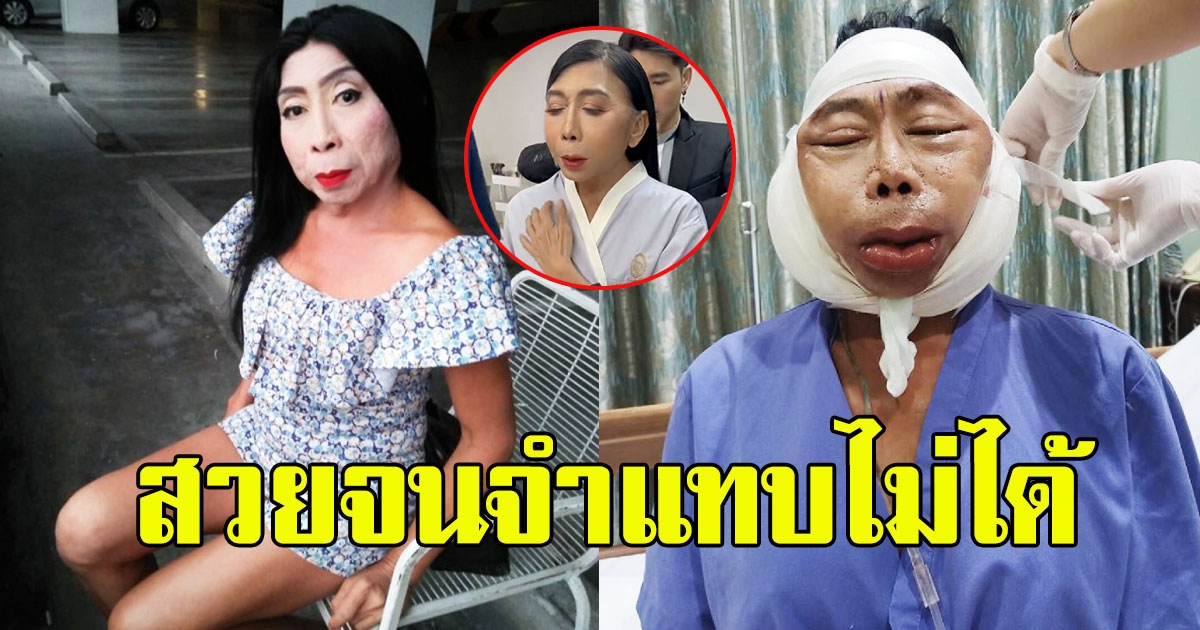 ภาพล่าสุด สิตางศุ์ บัวทอง หลังทำสวย