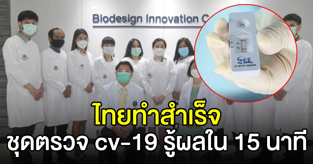 ศิริราช เผยผลสำเร็จวิจัยชุดตรวจ cv-19 รู้ผลไว 15 นาที