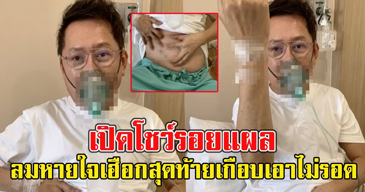 ณวัฒน์ เสียงสั่น