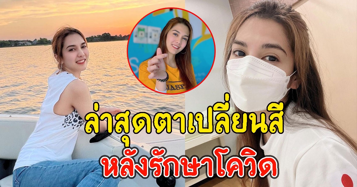 พั้นช์ วรกาญจน์ ตาเปลี่ยนสีหลังรักษาCV-19