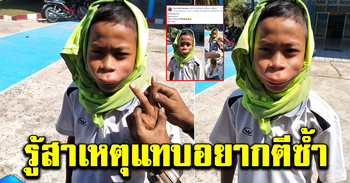 หนูน้อยกลับบ้านมา เห็นปากผิดปกติ