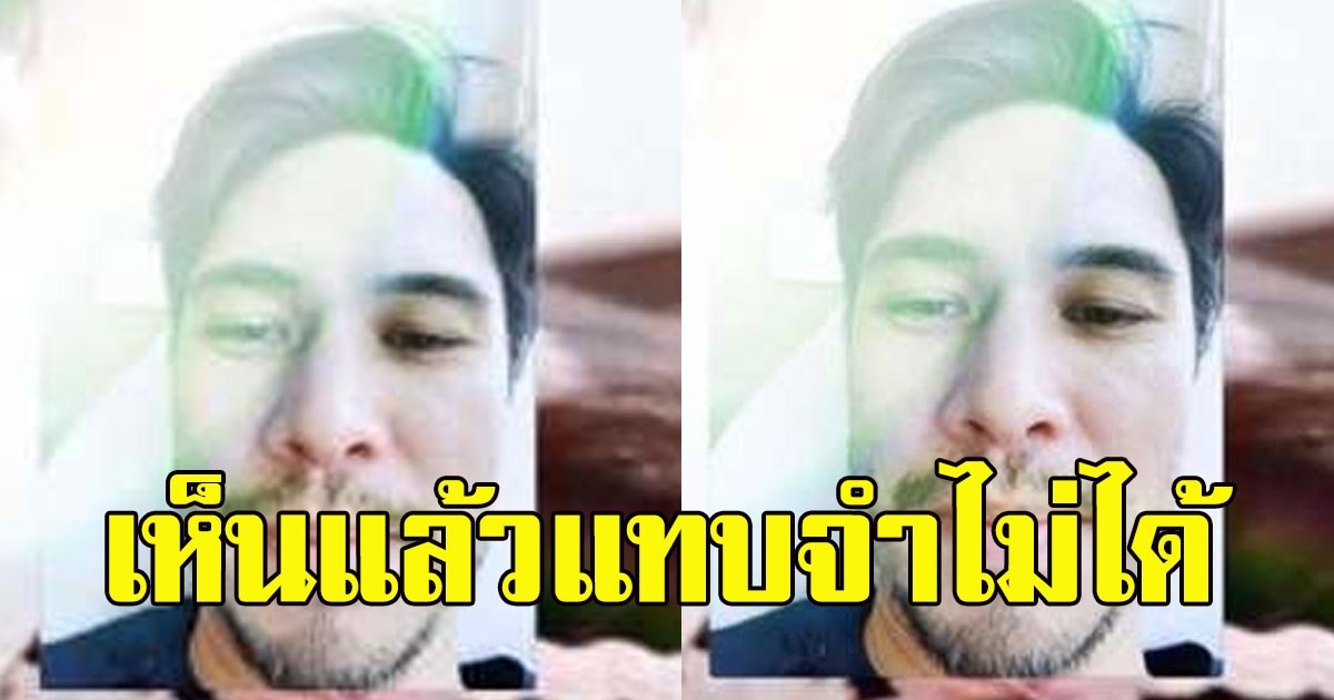 เปิดภาพล่าสุด แมทธิว ดีน หนวดเคราขึ้นเฟิ้ม หลังรักษาcovid ที่โรงบาล