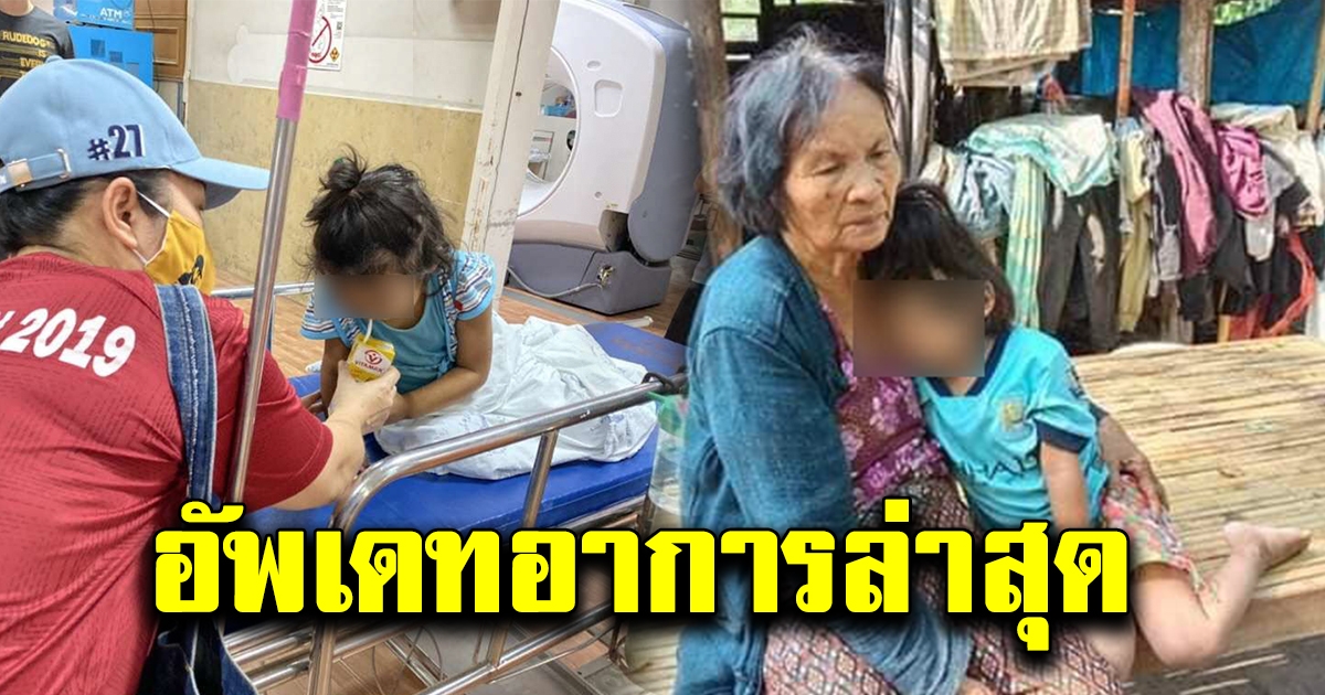 อัพเดทอาการล่าสุด หนูน้อยอ.เขมราฐวัย 4 ขวบ หลังรับการรักษา เกือบมาไม่ถึงหมอ