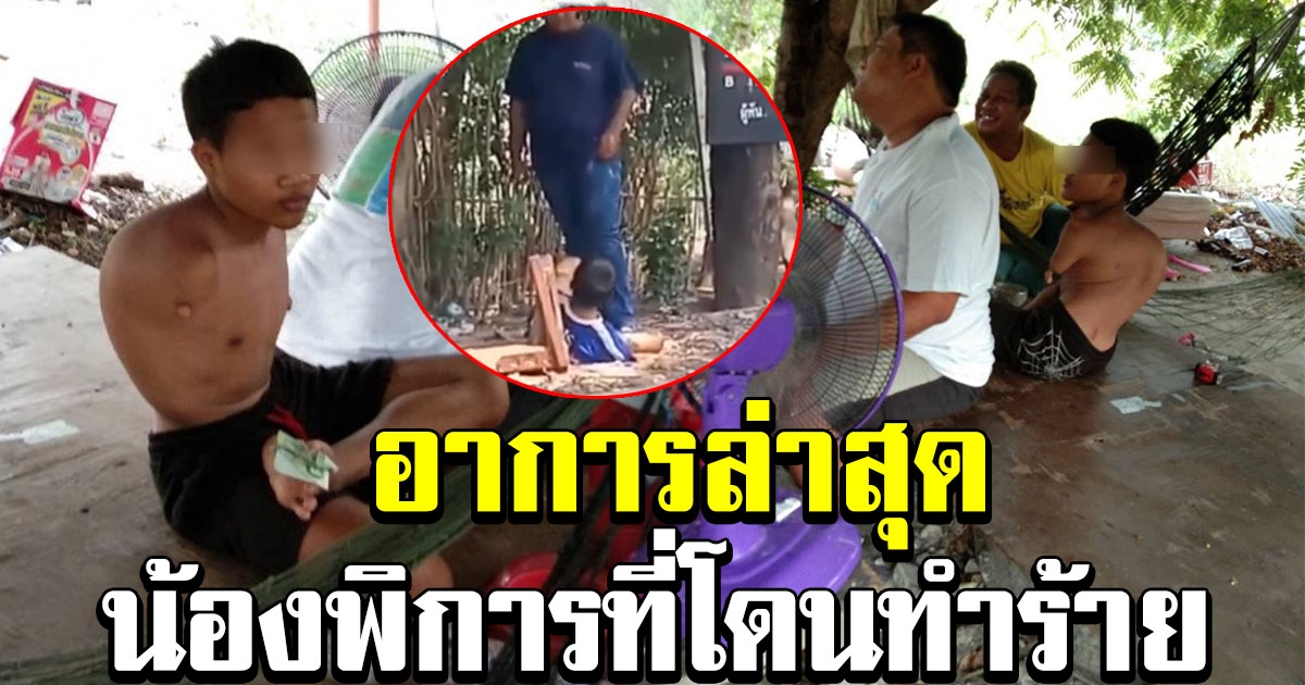 อาการล่าสุด น้องพิการไร้แขน ที่ถูกทำร้ายเตะต่อยไม่ยั้ง