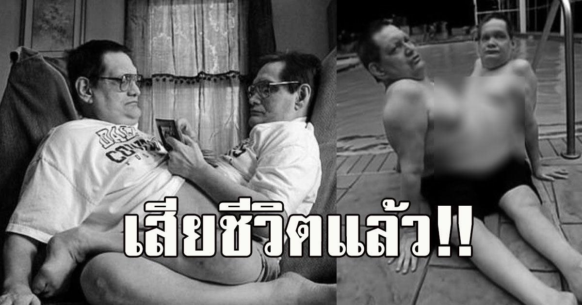 เสียชีวิตแล้ว ฝาแฝดตัวติดอายุยืนที่สุดในโลก