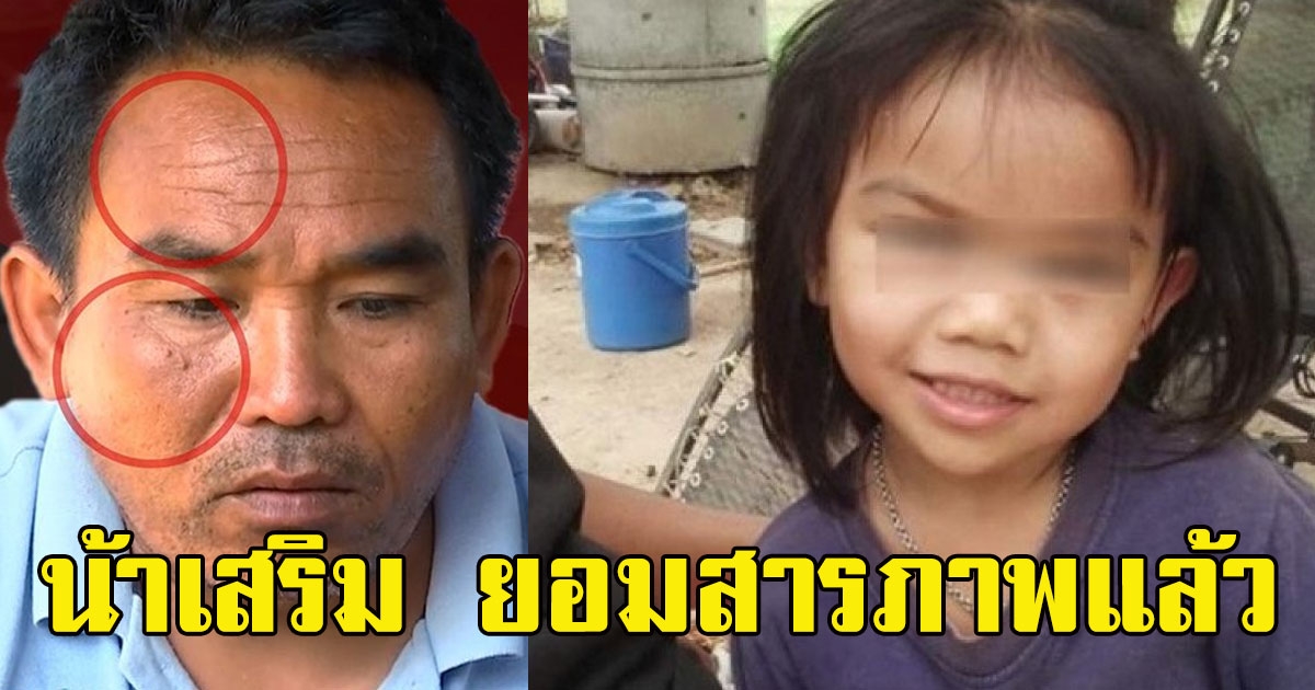น้าเสริม ยอมสารภาพแล้ว รอยช้ำบนหน้า งานนี้ชัดเจน
