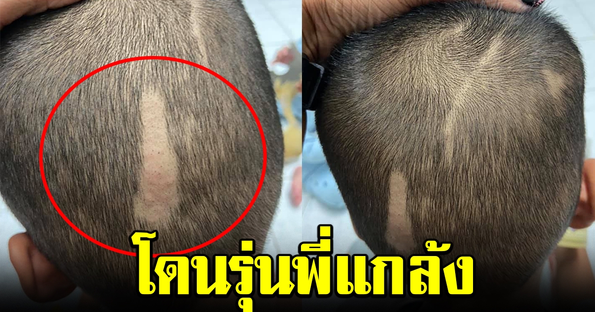 แม่ขอความเป็นธรรม ลูกชายโดนรุ่นพี่แกล้ง จนหัวแหว่ง พอได้ฟังคำพูดจากครู รับไม่ได้ทั้งโซเชียล