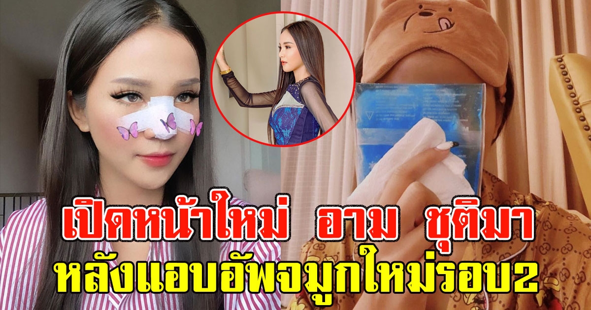 จำแทบไม่ได้ ภาพล่าสุด อาม ชุติมา