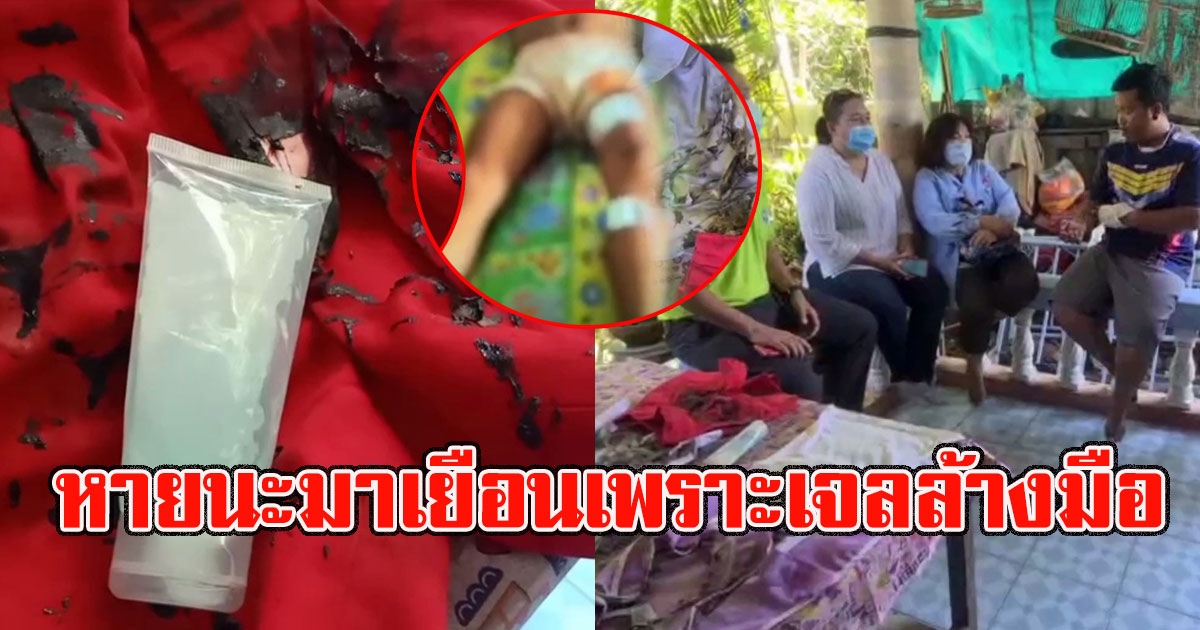 เด็กเล่นเจลล้างมือ พี่ชายเล่นไฟแช็ก ก่อนหายนะมาเยือน