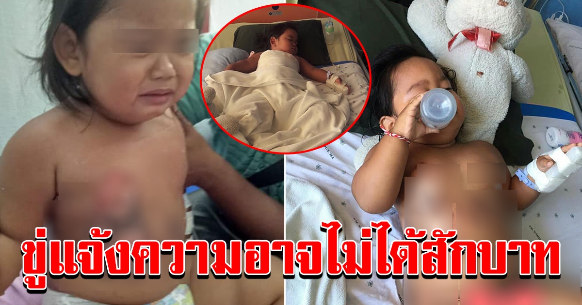 น่าสงสาร ร้านหมูกะทะทำน้ำซุปลวก 2 ขวบเจ็บ จ่าย 5 พันขอจบ บอกไม่ว่าง ออกตีกอล์ฟกับผู้ว่า