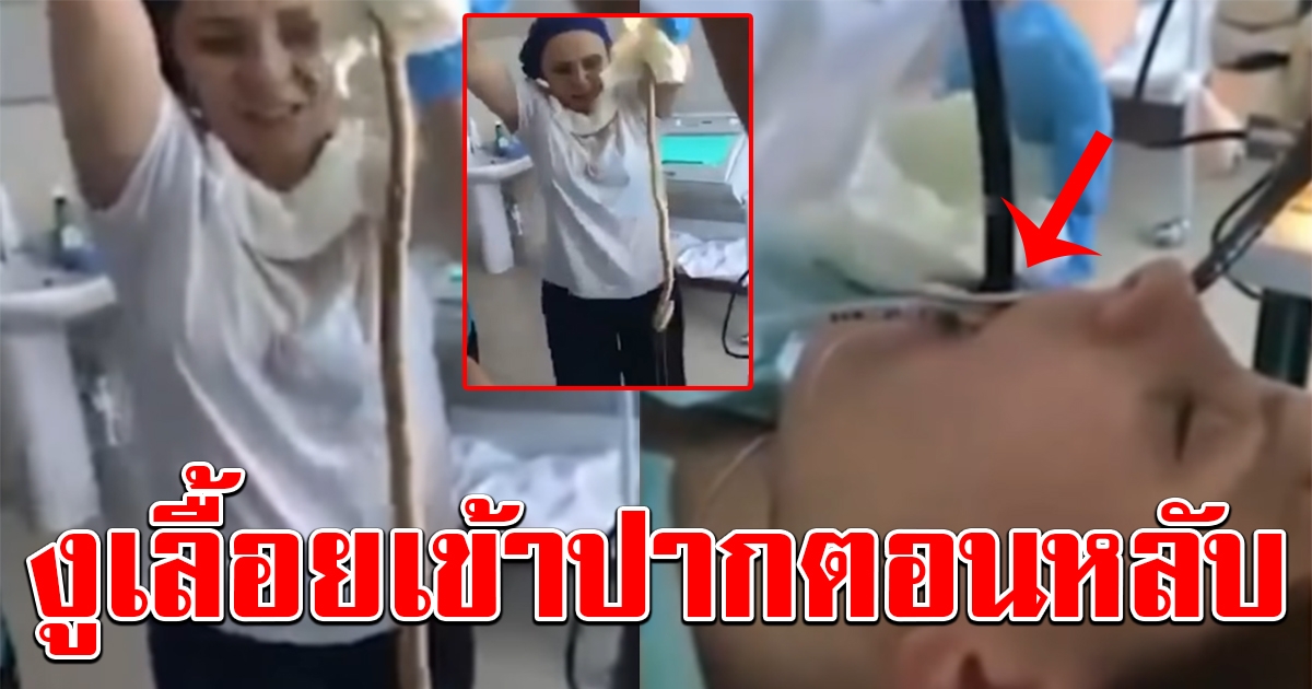 สาวนอนหลับ จนงูเลื้อยเข้าปาก ทีมแพทย์ต้องช่วยกันดึงออก