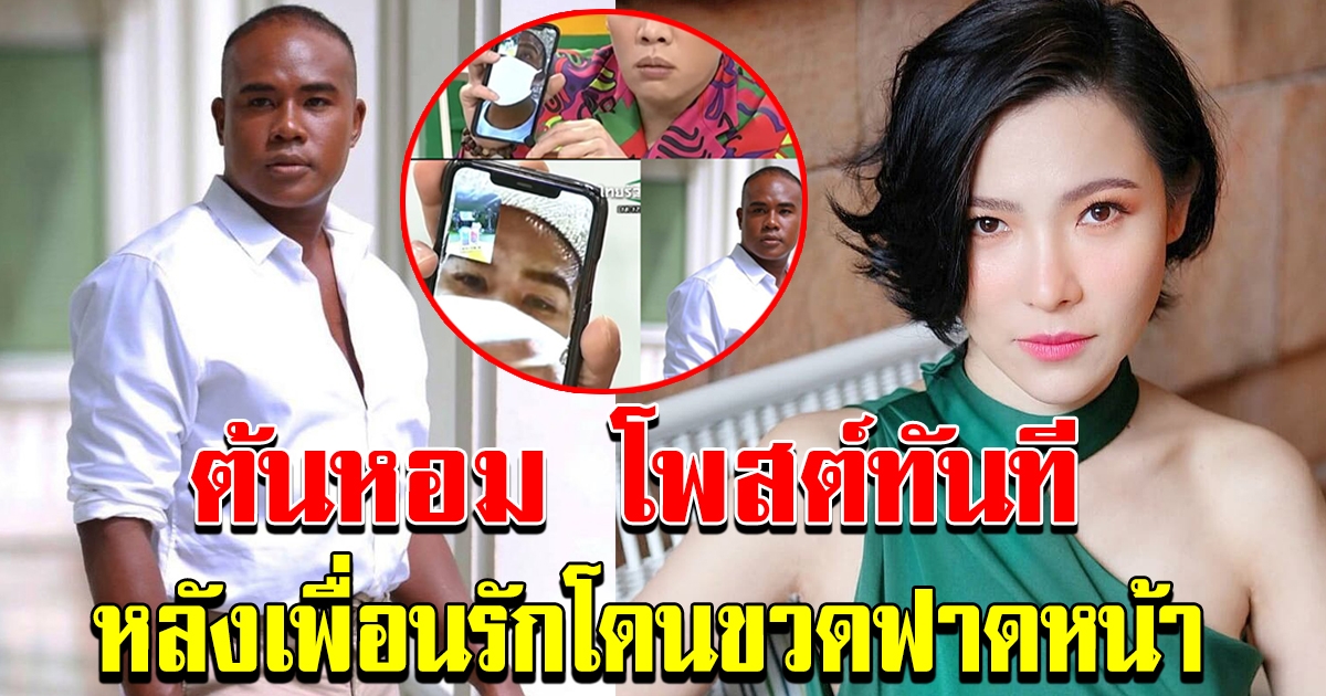 ต้นหอม ทนไม่ไหว ประกาศ กลางไอจี ถึงรัศมีแข