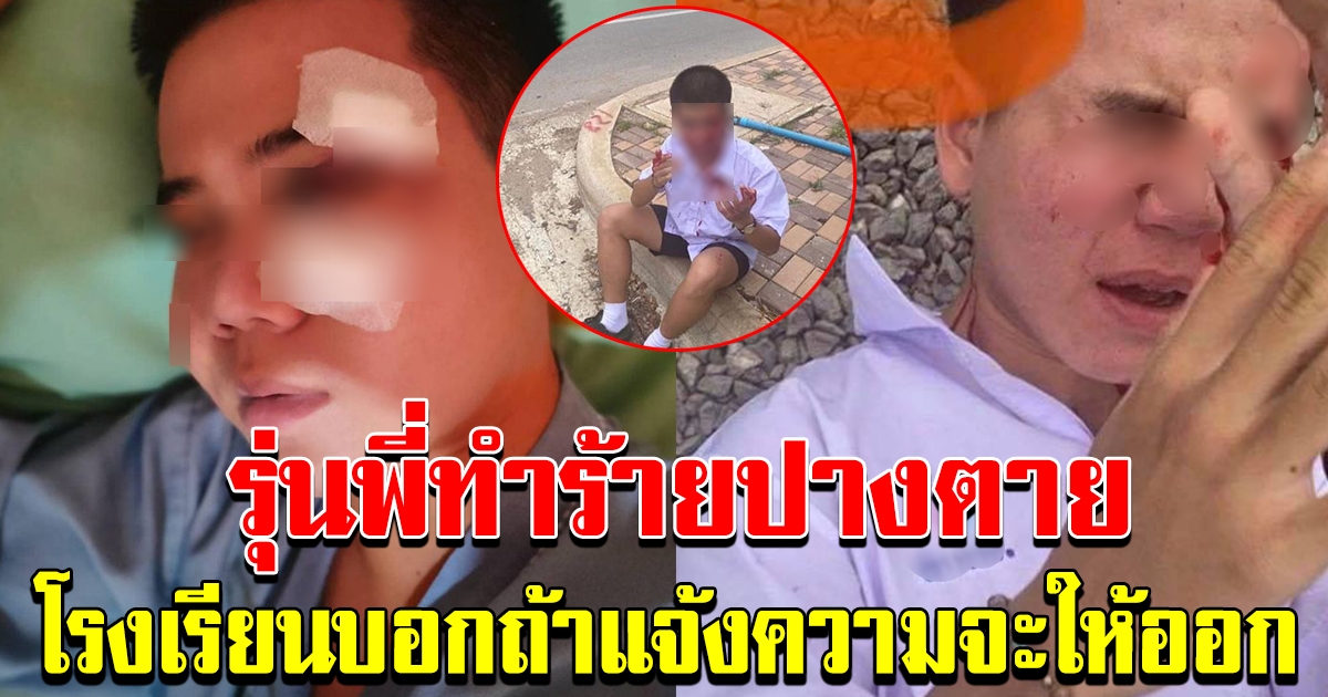 รุ่นพี่ซ้อมรุ่นน้องเจ็บปางตาย รุ่นพี่ข่มขู่ห้าม แจ้งความ