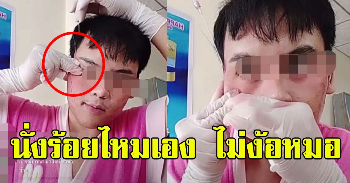 หนุ่มหน้าสวย นั่งร้อยไหมเอง ไม่พึ่งหมอ เห็นแล้วจะเป็นลม