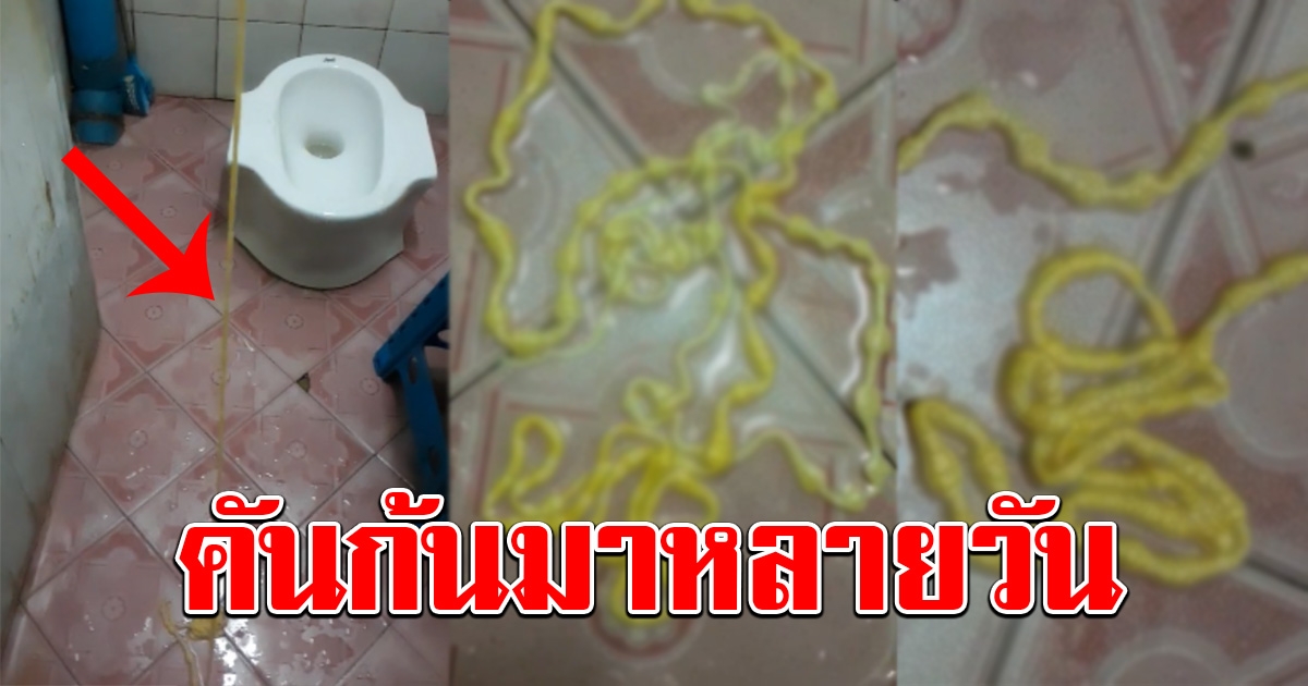 หนุ่มคันก้นมาหลายวัน ก่อนเข้าห้องน้ำ แทบช็อก เจอเต็มๆตัวยาวเป็นเมตร