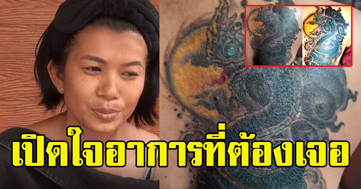 เปิดใจสาวสัก พญานาค ล่าสุด  สีเปลี่ยน-คันไม่หยุด