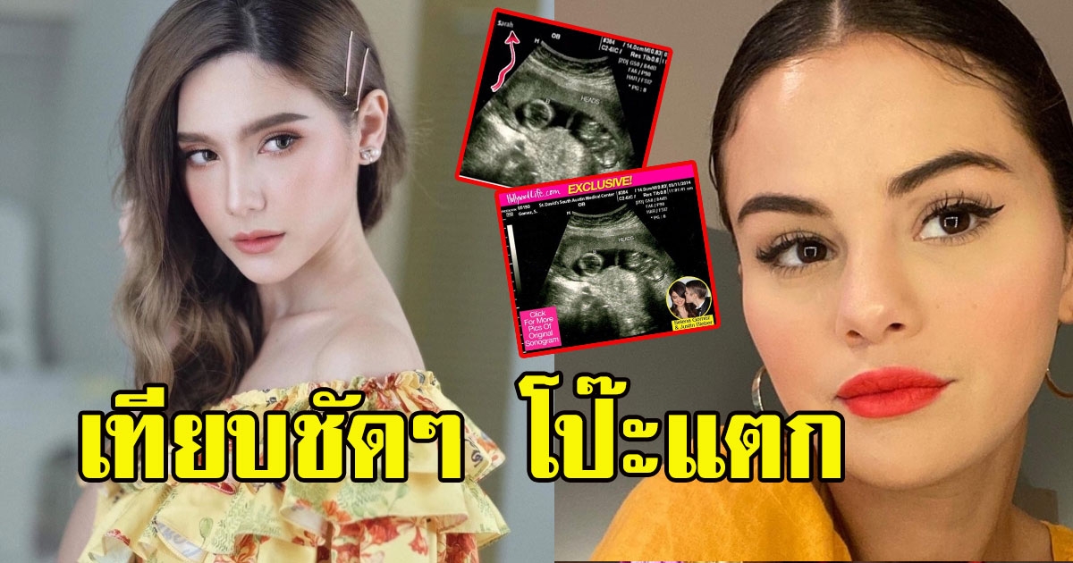 ซาร่า โป๊ะอีก ภาพอัลตร้าซาวด์ทำไม เหมือนของ เซเลน่า โกเมซ