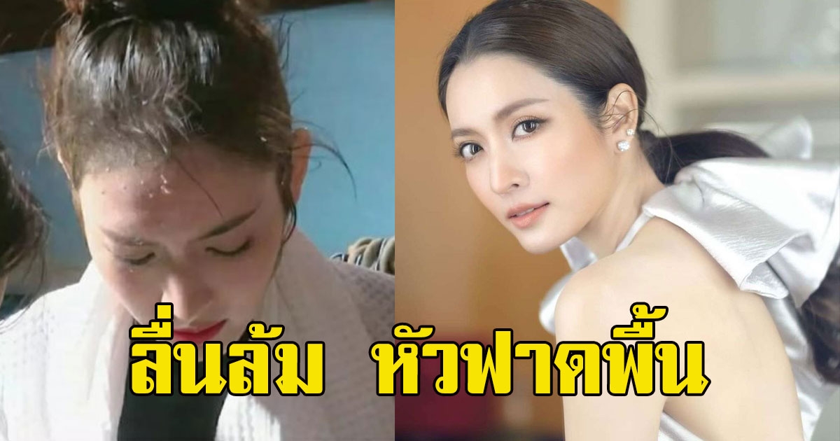 แห่ส่งกำลังใจด่วน แอฟ ทักษอร ลื่นล้ม หัวฟาดพื้น ขณะที่กำลังถ่ายละคร