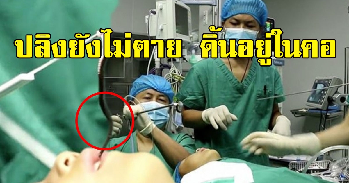 หมอดึง ปลิง ตัวเป็นๆ ติดอยู่ในลำคอเด็ก 5 ขวบ นานเป็นปี