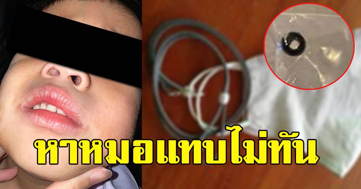 แม่ช็อก ลูกชาย 4 ขวบ ใส่แมสก์ ก่อนเกิดเรื่องหาหมอแทบไม่ทัน
