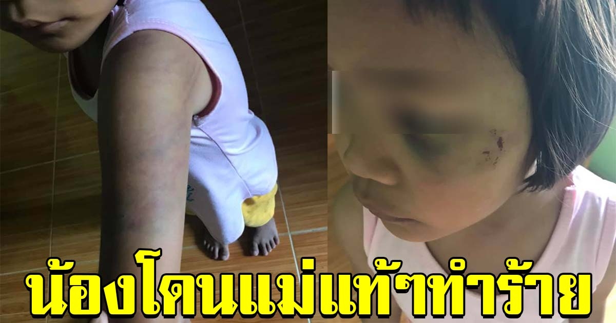 สาวทนไม่ไหว เห็นหนูน้อย ถูกแม่แท้ๆทำร้ายบ่อย วอนช่วยเหลือ