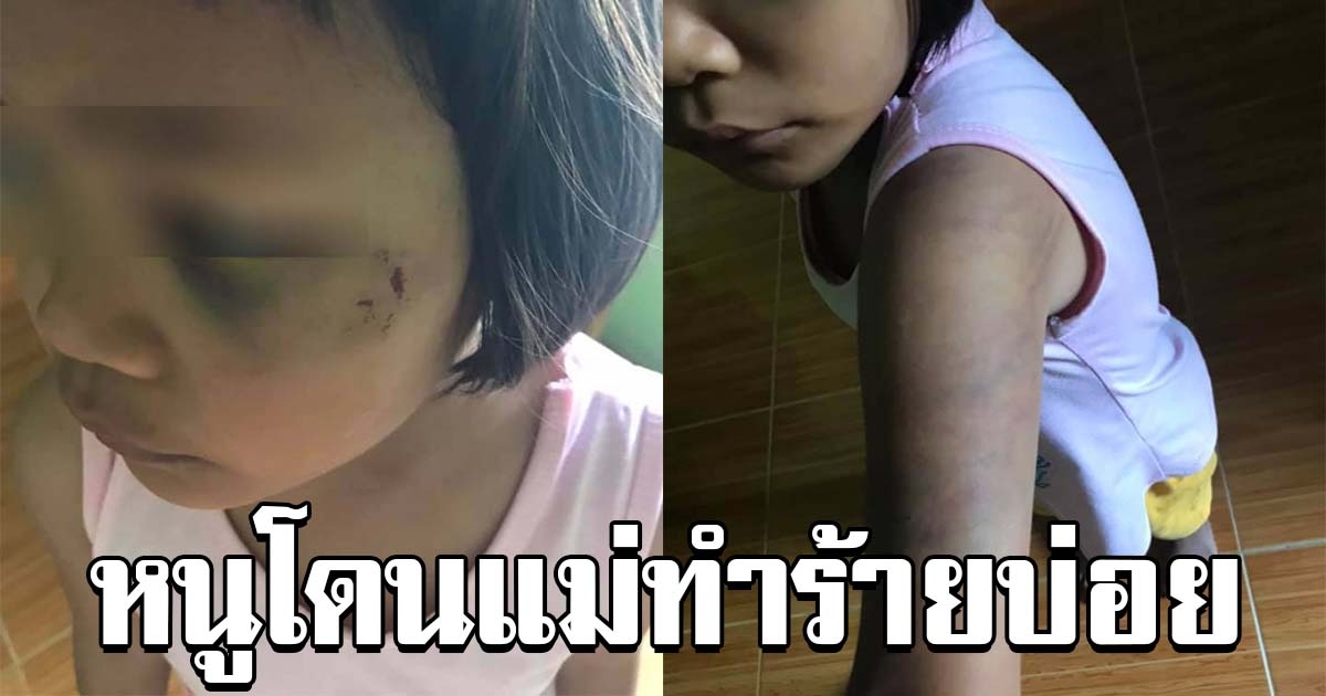 สาวทนไม่ไหว เด็กข้างบ้าน ถูกแม่แท้ๆทำร้ายบ่อย