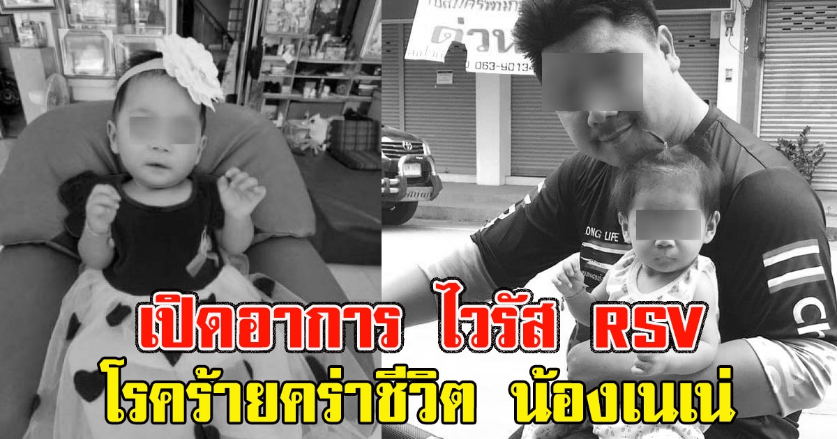 เปิดอาการ ไวรัส RSV โรคร้ายคร่าชีวิต น้องเนเน่