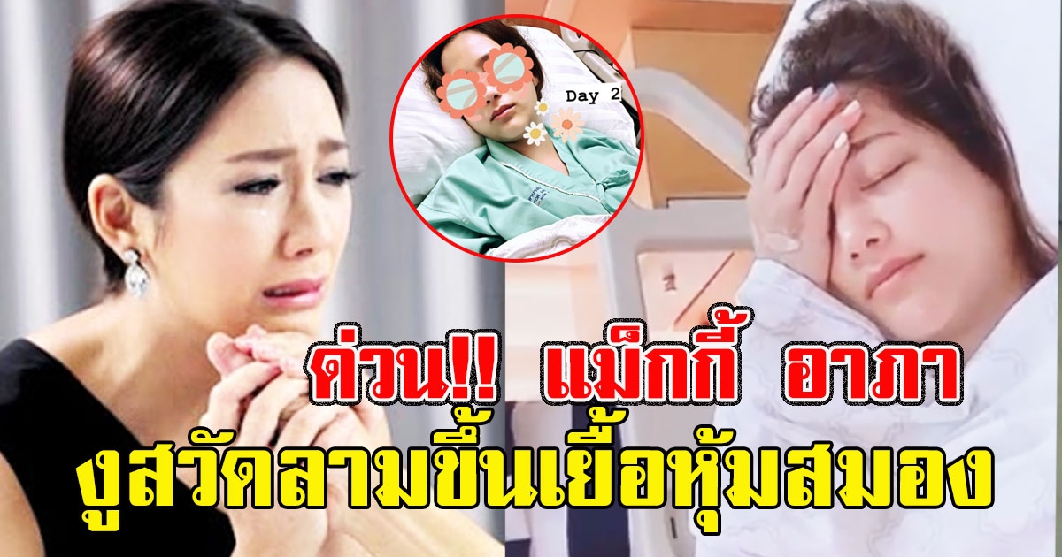 ด่วน ดาราสาว แม็กกี้ อาภา ตรวจพบเชื้องูสวัดลามขึ้นสมอง