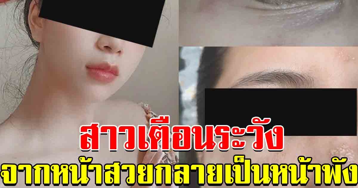 สาวเตือนระวังให้ดี แมลงก้นกระดก จากหน้าสวยกลายเป็นหน้าพัง