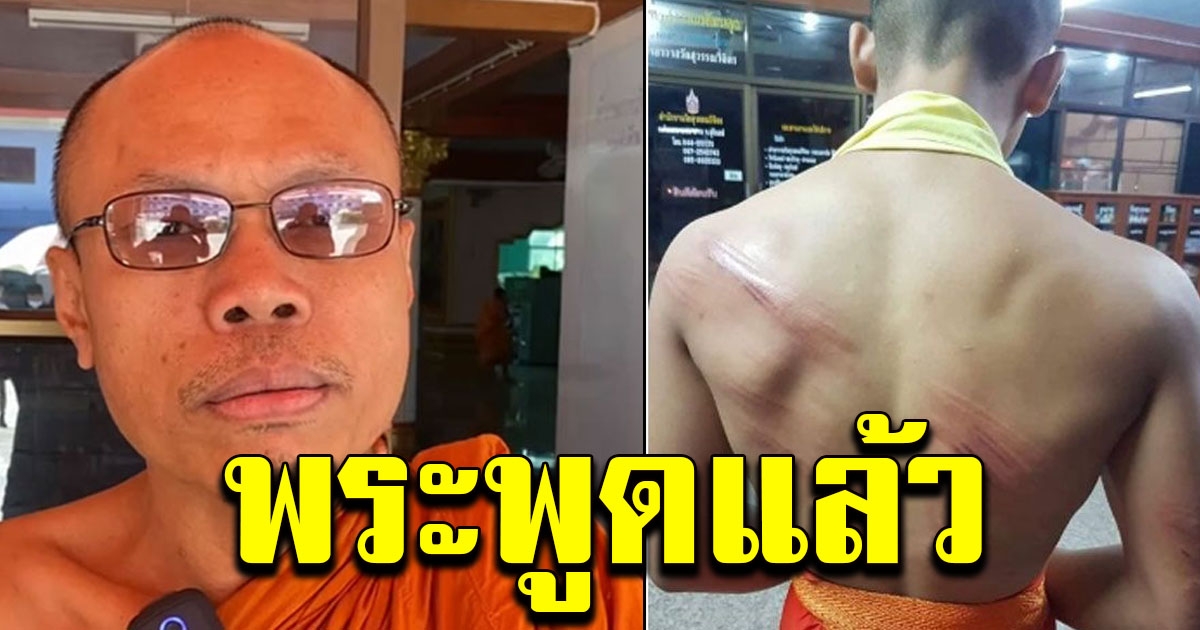 รองเจ้าวัด รับ ทำโทษเณรจริง พร้อมเผยสาเหตุ