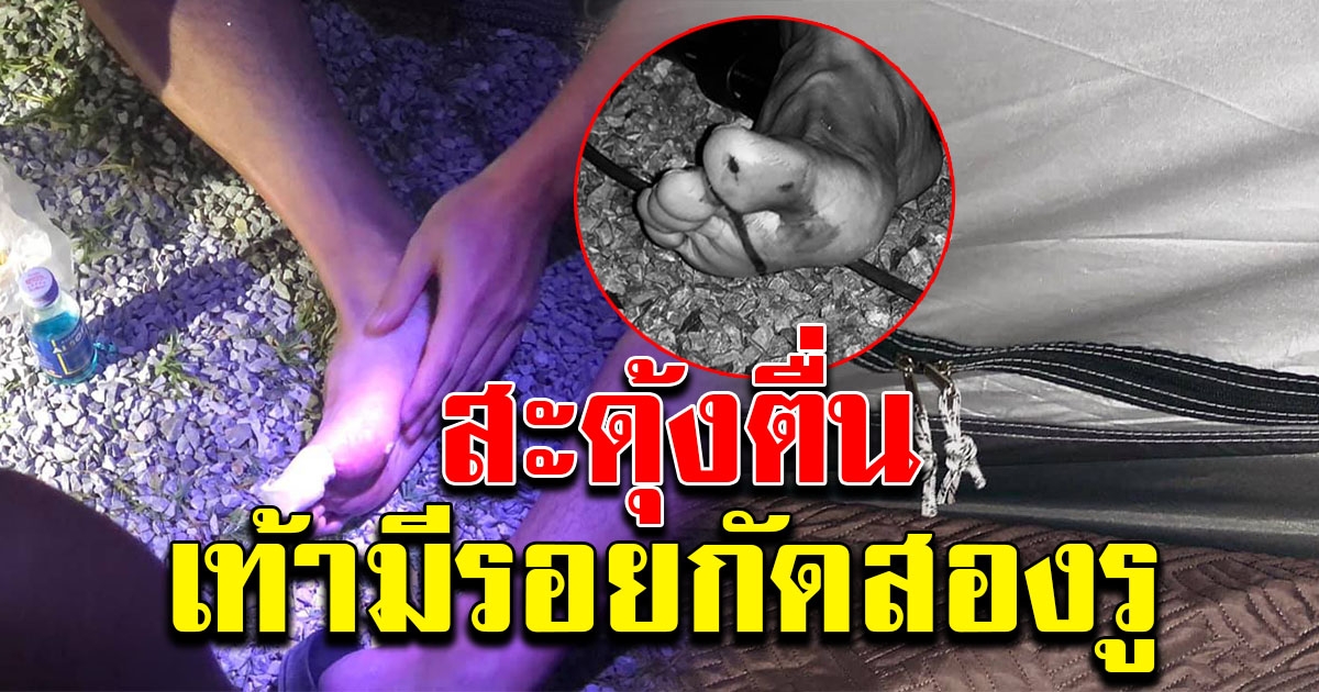 หนุ่มกางเต็นท์นอน สะดุ้งตื่นมีรอยโดนกัด