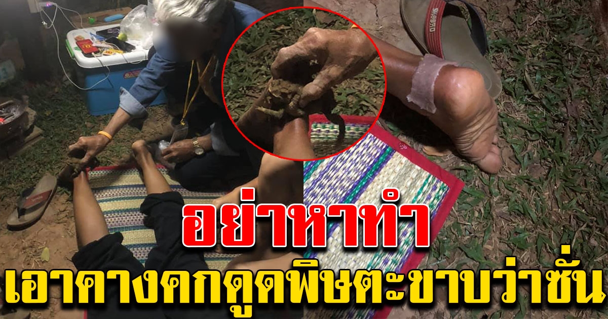 หมอแล็บเตือน อย่าหาทำ หลังมีคนเอาคางคกมาดูดพิษตะขาบ