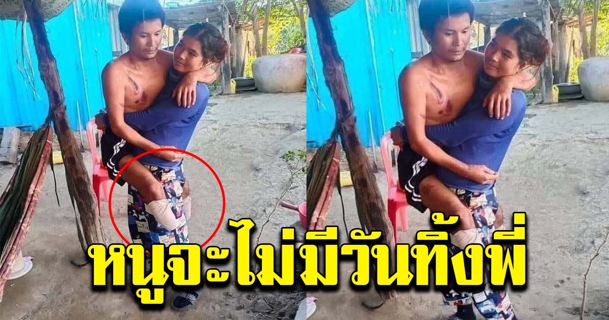 สาวอุ้มแฟนหนุ่ม ที่พิการจากอุบัติเหตุ ลั่น จะอยู่ดูแลกันและกันตลอดไป