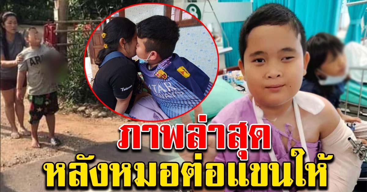 จำได้ไหม น้องแมนยู เด็กตาบอดยอดกตัญญู เผยอาการล่าสุด หลังหมอต่อแขนให้