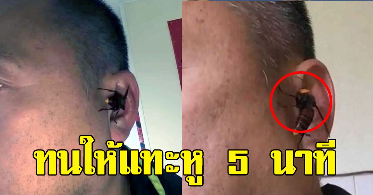 หนุ่มทนให้แตนยักษ์แทะหู 5 นาที ไม่กล้าปัดออกเพราะขึ้นชื่อพิษคร่าชีวิตคนได้